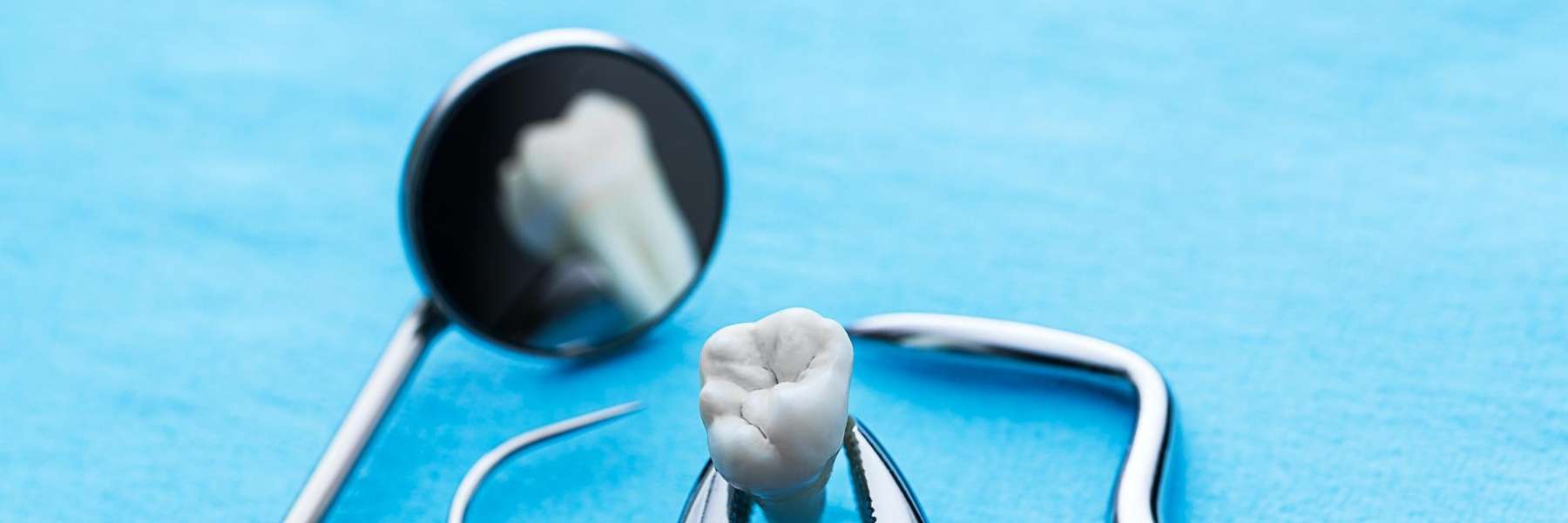 tooth extraction | dentist Camas WA