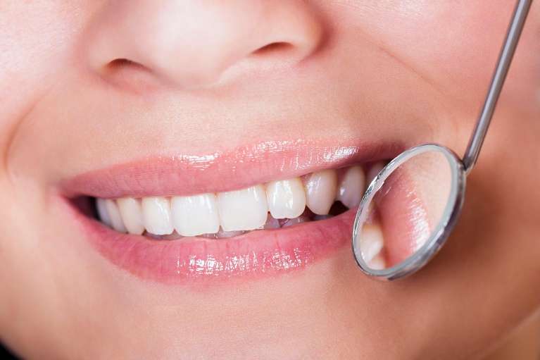 dental cleaning camas wa